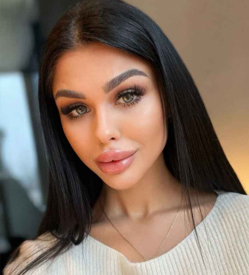 Nicole - short stay